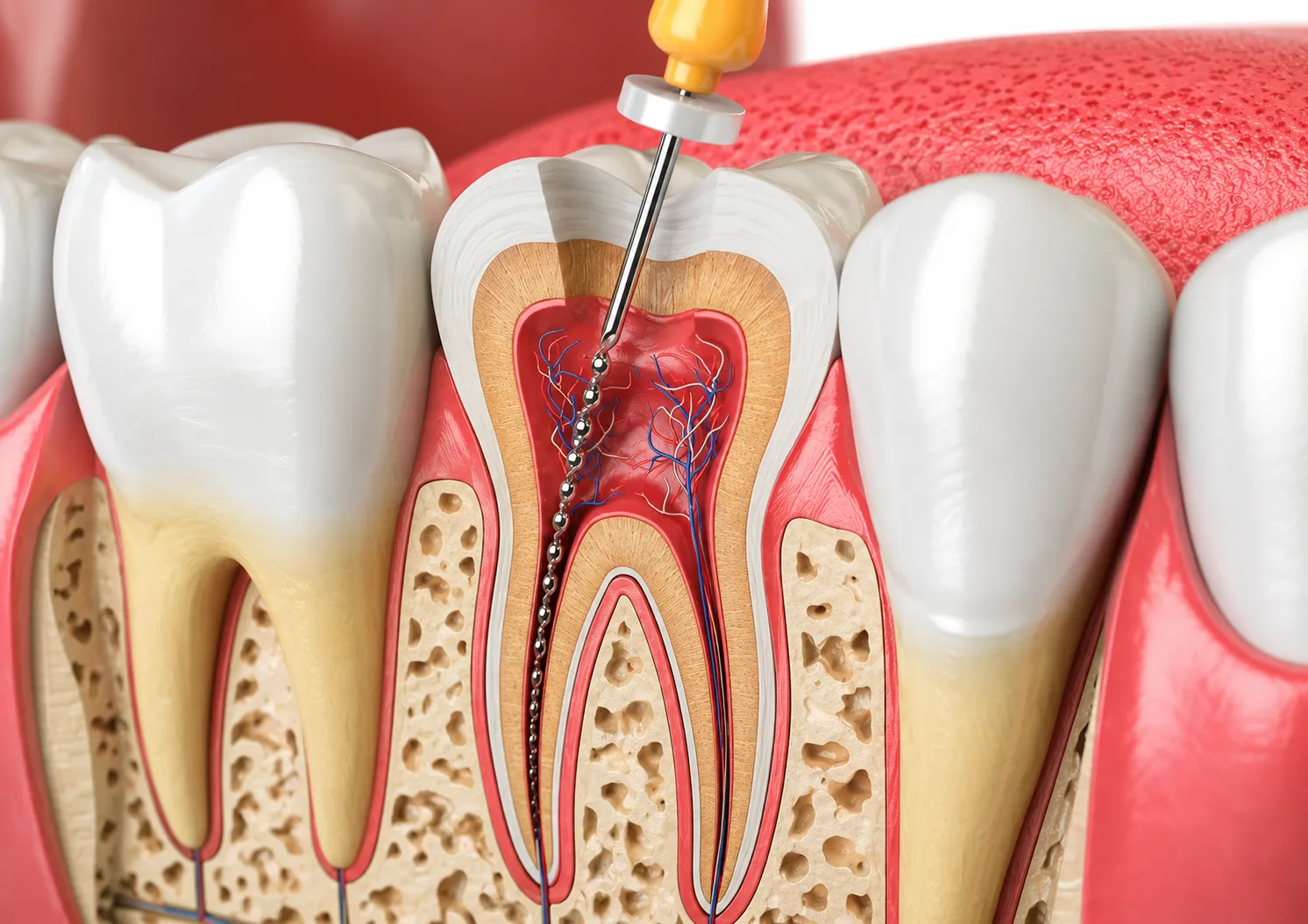 I HAVE TOOTH PAIN